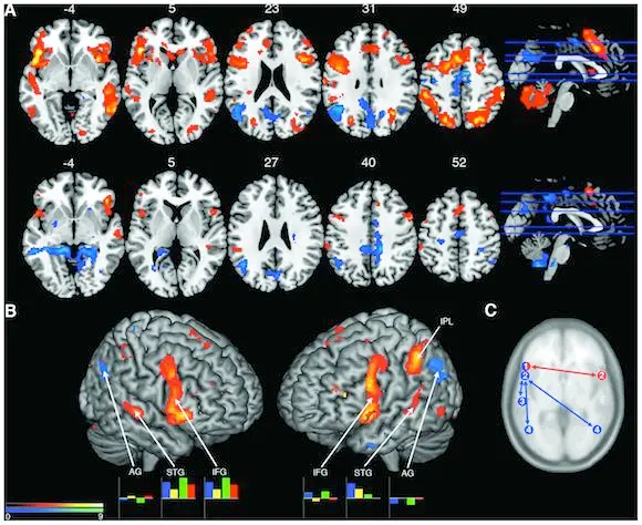 Brain scan images in orange and blue showing activity patterns in jazz musicians improvising